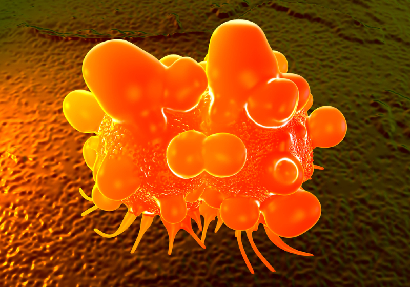 Bowel cancer cell