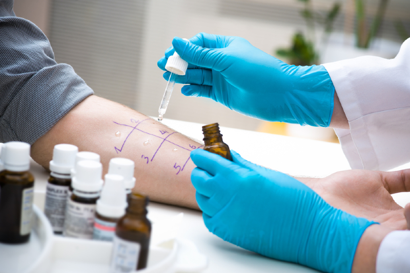 Skin prick testing