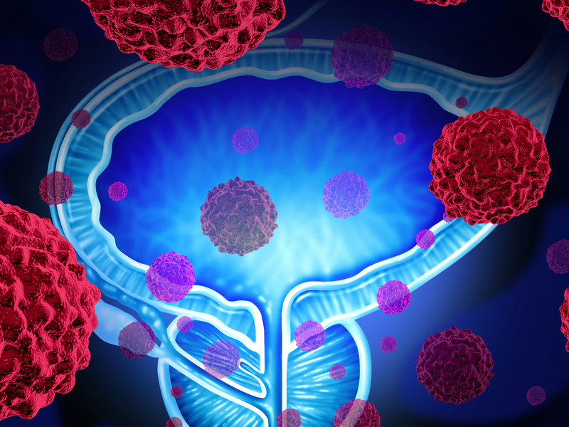 Graphic showing prostate cancer cells